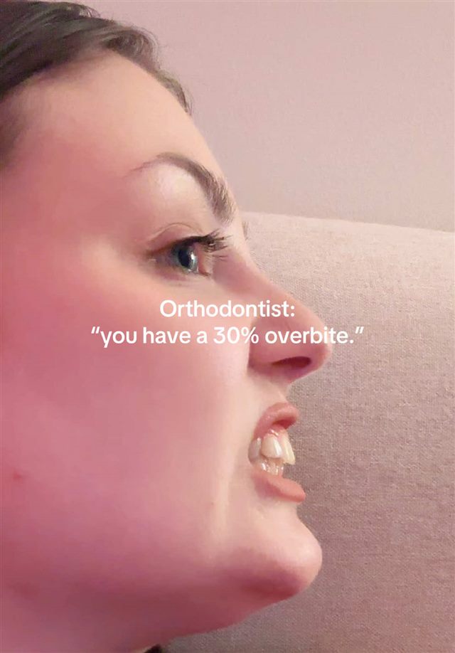 wabi-sabi trend TikTok video showing an overbite